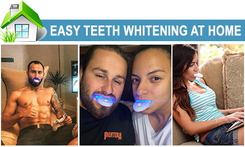 GLORY SMILE TEETH WHITENING PRODUCTS (HP) -