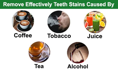 GLORY SMILE TEETH WHITENING PRODUCTS (HP) -