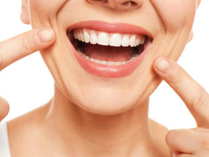 V34 Teeth Colour Corrector - GlorySmile
