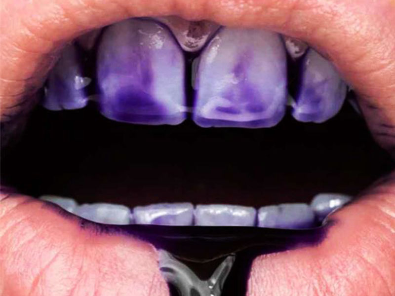 GlorySmile No1 Teeth Whitening Productsac