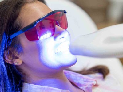 teeth-whitening-at-dentist (1)